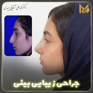 جراحی-بینی-03