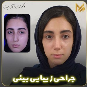 جراحی-بینی-04