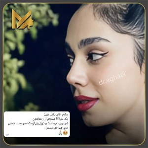 جراحی-بینی-19