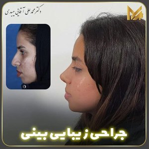جراحی-بینی-5