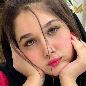 rhinoplasty-77