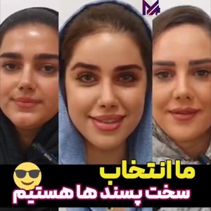 rhinoplasty-84