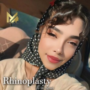 rhinoplasty-94