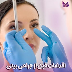 اقدامات قبل از جراحی بینی