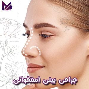 جراحی بینی استخوانی - دکتر آقایی