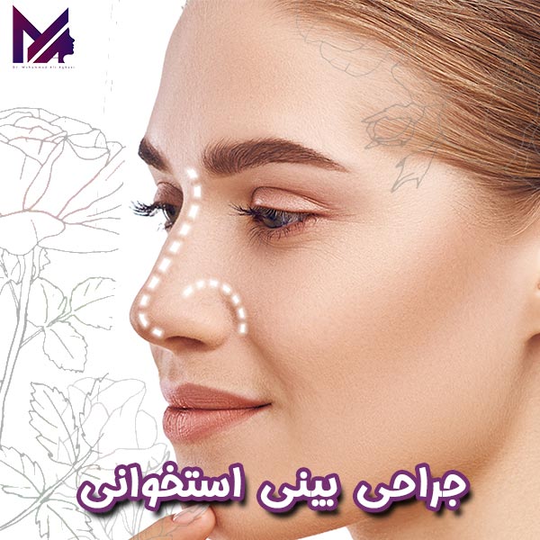 جراحی بینی استخوانی - دکتر آقایی