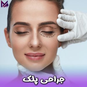 جراحی پلک