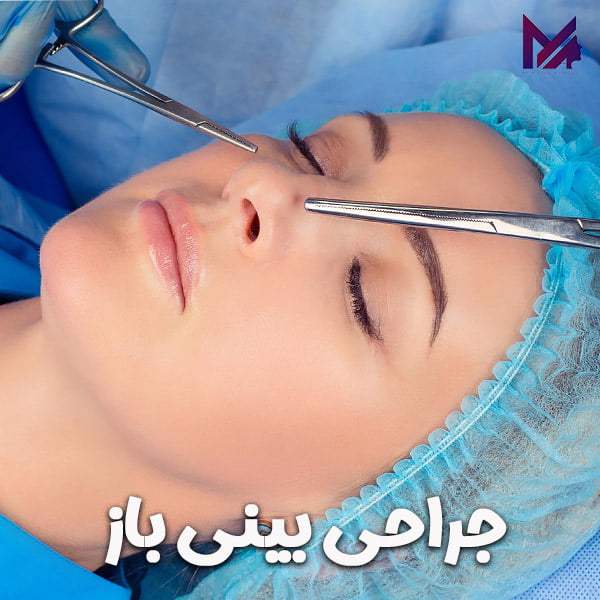 جراحی بینی باز