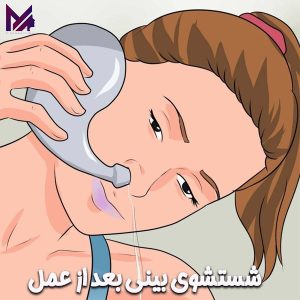 شستشوی بینی بعد از عمل