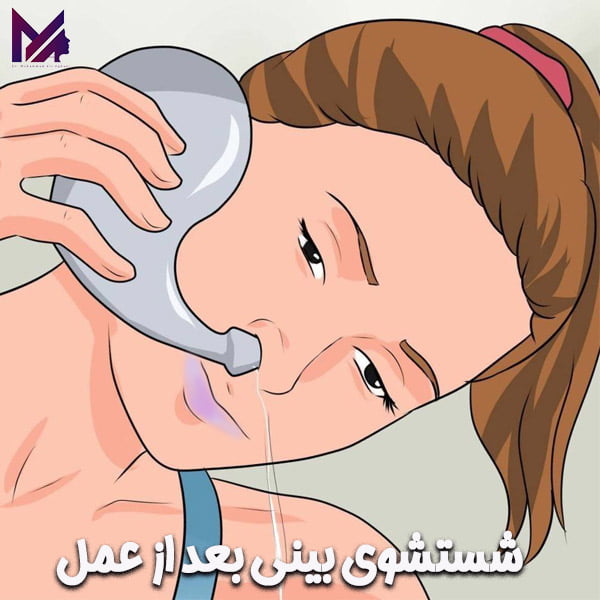 شستشوی بینی بعد از عمل