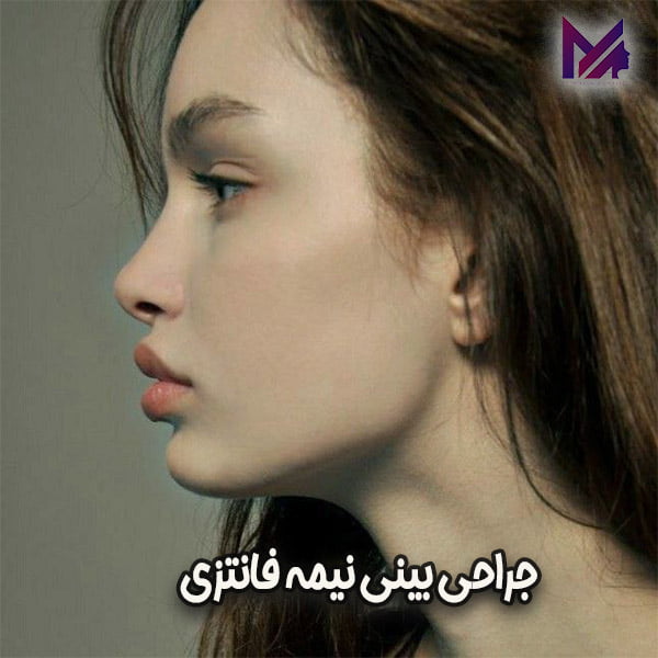 جراحی بینی نیمه فانتزی - دکتر اقایی