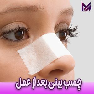 چسب بینی بعد از عمل - دکتر آقایی