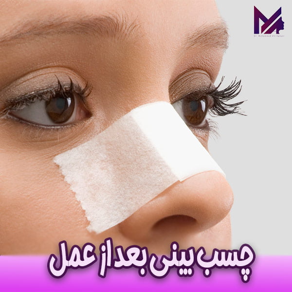 چسب بینی بعد از عمل - دکتر آقایی