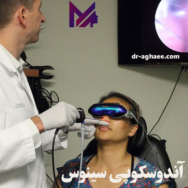 آندوسکوپی سینوس - دکتر محمدعلی آقایی https://dr-aghaee.com/