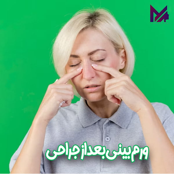 ورم بینی - دکتر محمد علی اقایی