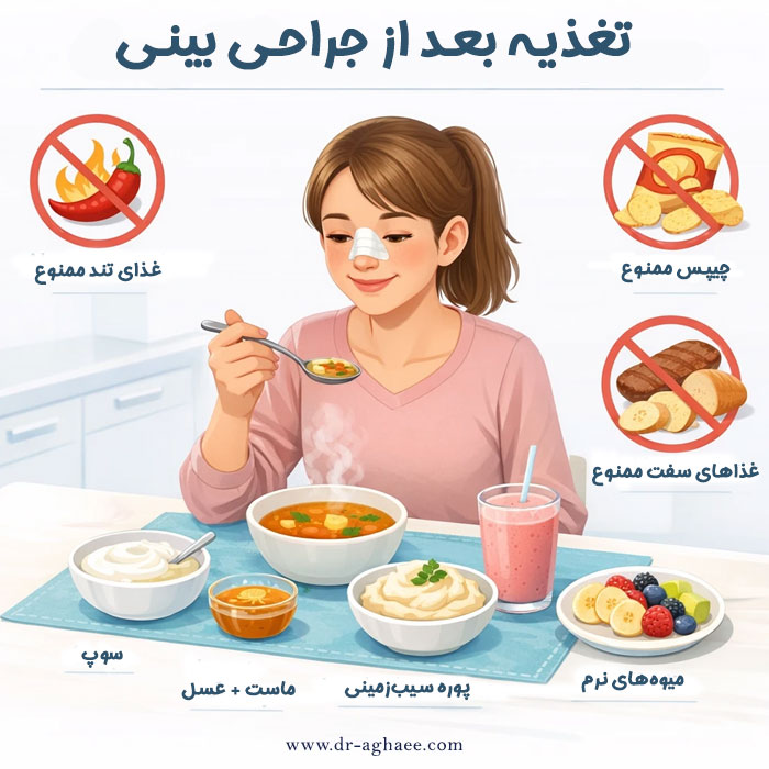 تغذیه بعد از جراحی بینی + دکتر محمدعلی آقایی