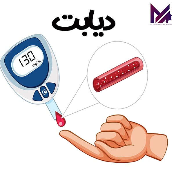 جراحی بینی و بیماری ها خاص_دکتر محمد علی آقایی