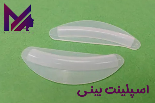 اسپلینت بینی https://dr-aghaee.com/