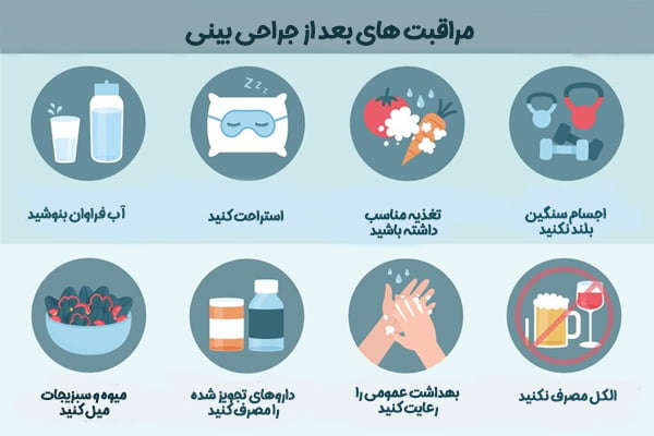 مراقبت های بعد از جراحی بینی فانتزی - دکتر محمدعلی آقایی