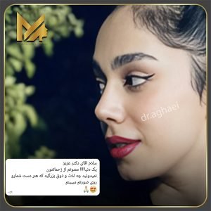 نمونه کار عمل بینی توسط بهترین جراح بینی یزد