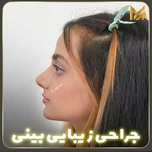 نمونه عمل بینی توسط جراح خوب بینی در یزد دکتر محمدعلی آقایی