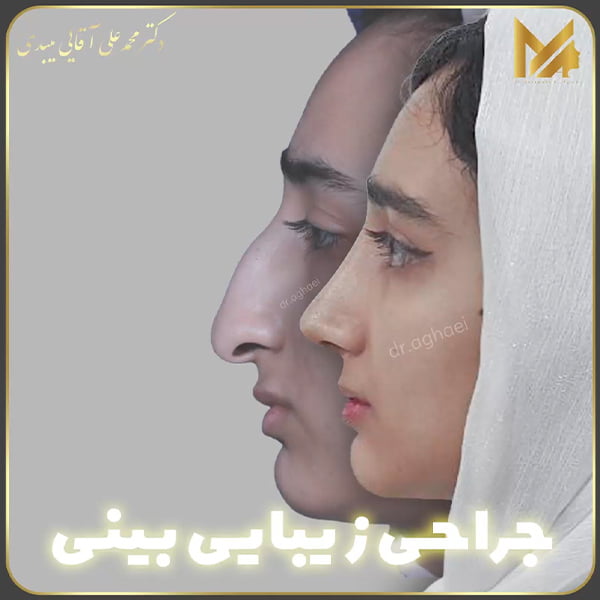 بهترین جراح بینی در یزد - دکتر محمدعلی آقایی