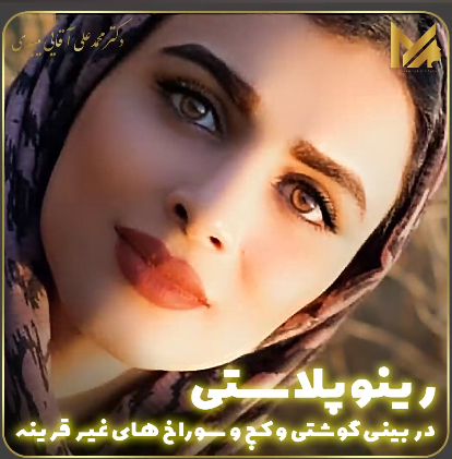 جراحی بینی گوشتی 2 - دکتر محمد علی آقایی 