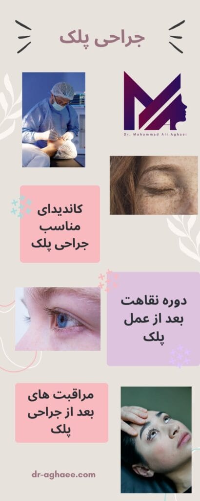 جراحی پلک https://dr-aghaee.com/