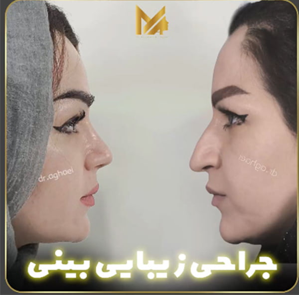 جراحی بینی - دکتر محمدعلی آقایی