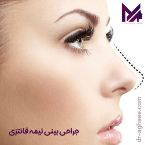 جراحی بینی نیمه فانتزی https://dr-aghaee.com/