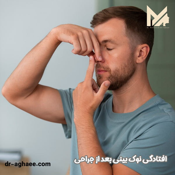 افتادگی نوک بینی بعد از جراحی - دکتر محمدعلی آقایی
