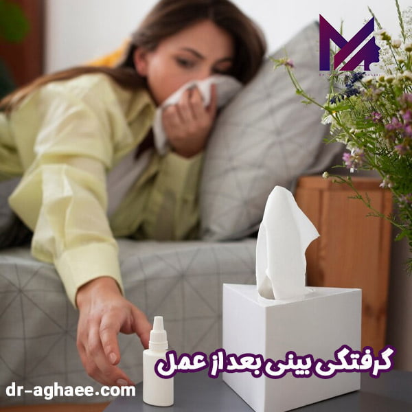 گرفتگی بینی بعد از عمل - دکتر محمدعلی آقایی