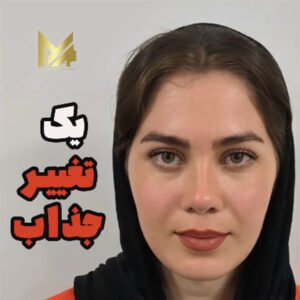 عمل بینی در یزد 1