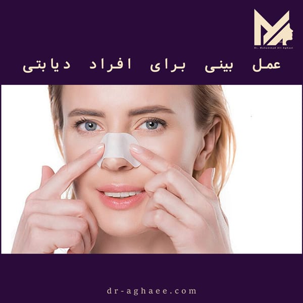 عمل بینی برای افراد دیابتی https://dr-aghaee.com/