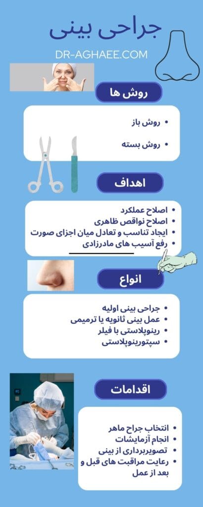 جراحی بینی در یزد https://dr-aghaee.com/