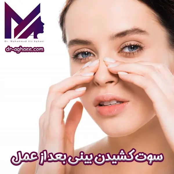 سوت کشیدن بینی بعد از عمل