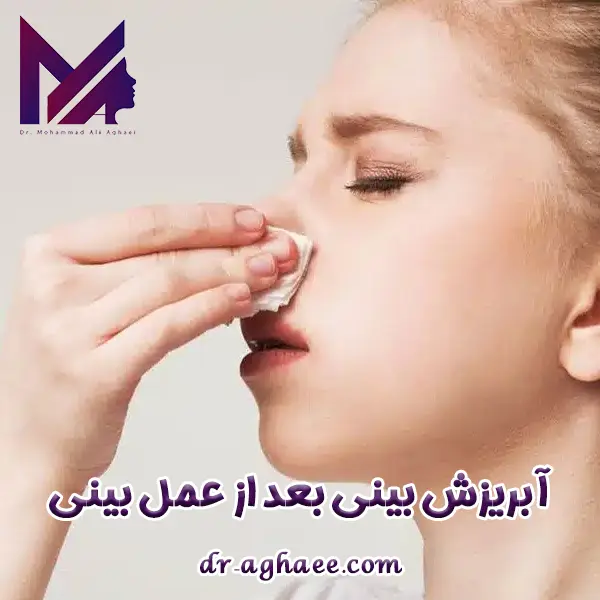 آبریزش بینی بعد از عمل