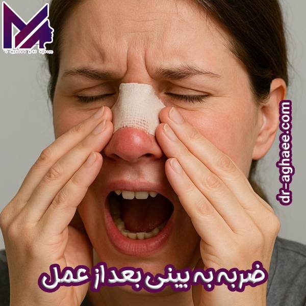 ضربه به بینی بعد از عمل