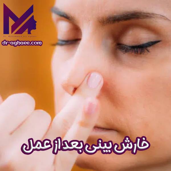 خارش بینی بعد از عمل