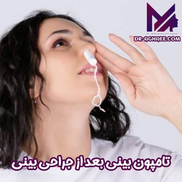 تامپون بینی