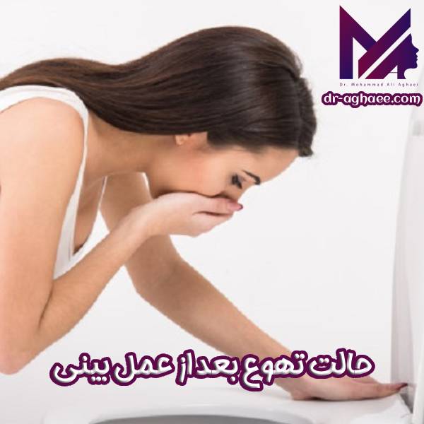 حالت تهوع بعد از عمل بینی