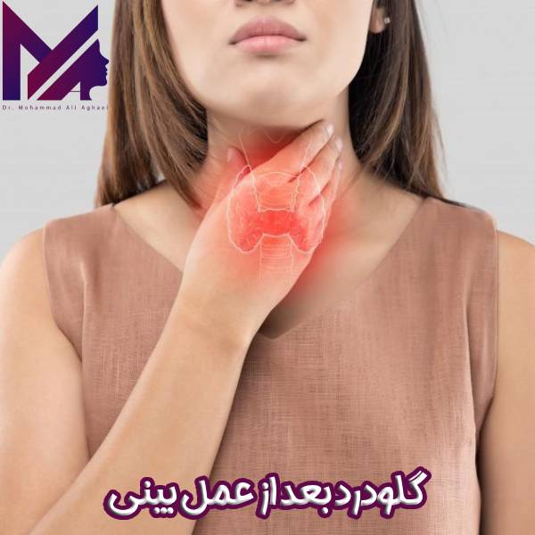 گلودرد بعد از عمل بینی
