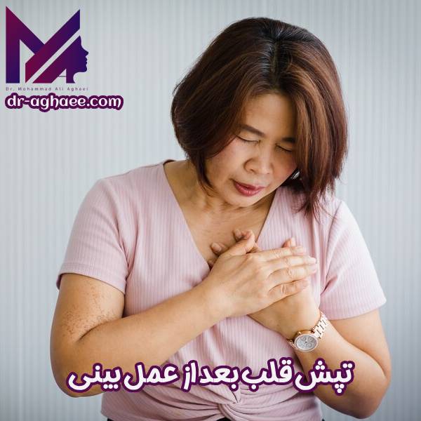 تپش قلب بعد از عمل بینی