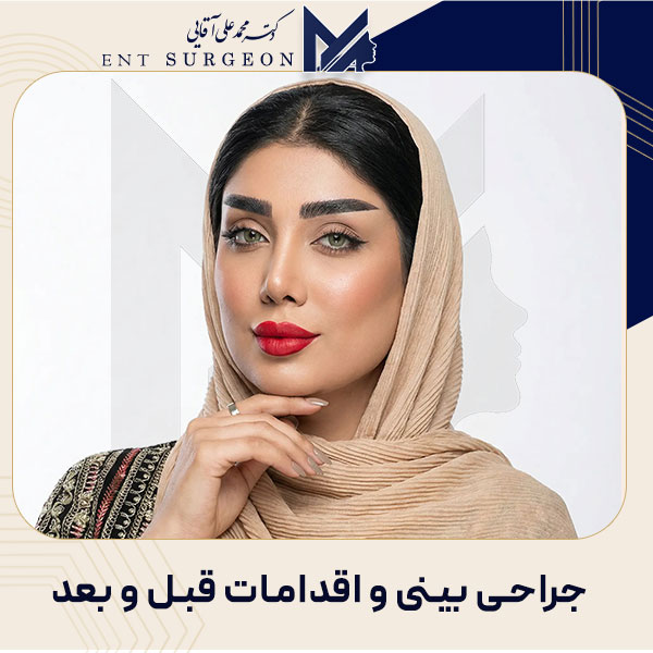 جراحی بینی در یزد + دکتر محمدعلی آقایی