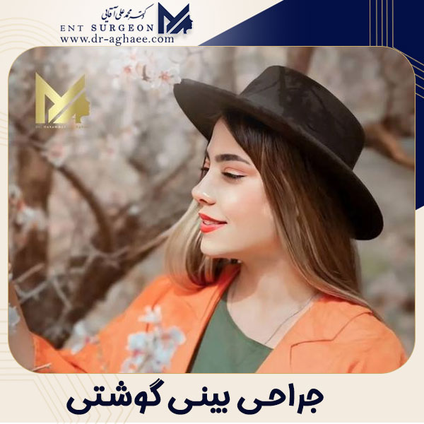 جراحی بینی گوشتی در یزد | دکتر محمدعلی آقایی
